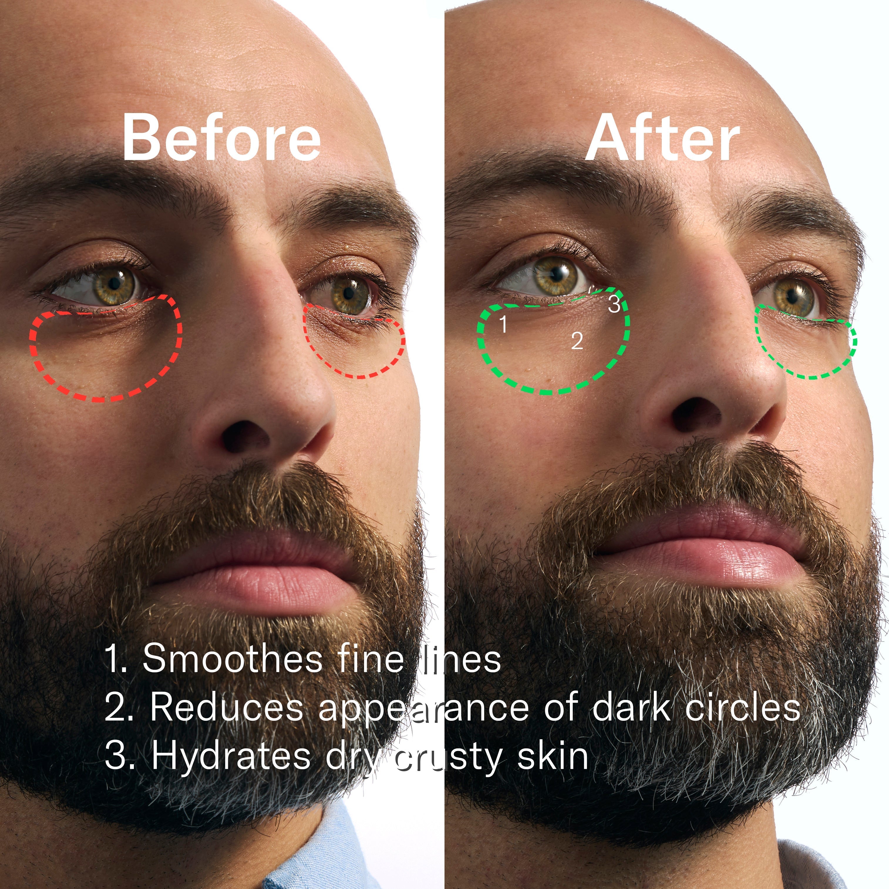 Rapid Restore Eye Patches - 6 pack